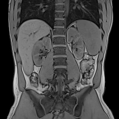 Снимок МРТ пищевода, желудка, кишечника